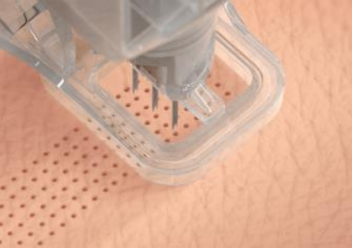 Micro-Core
