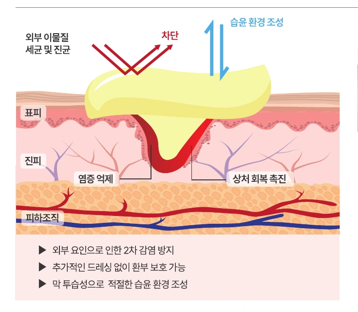 KIODYN Plus 반투과성 보호막 작용