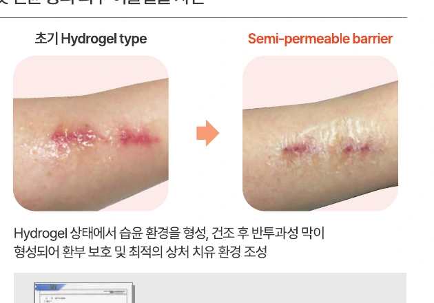 KIODYN Plus 보호막 형성 전후